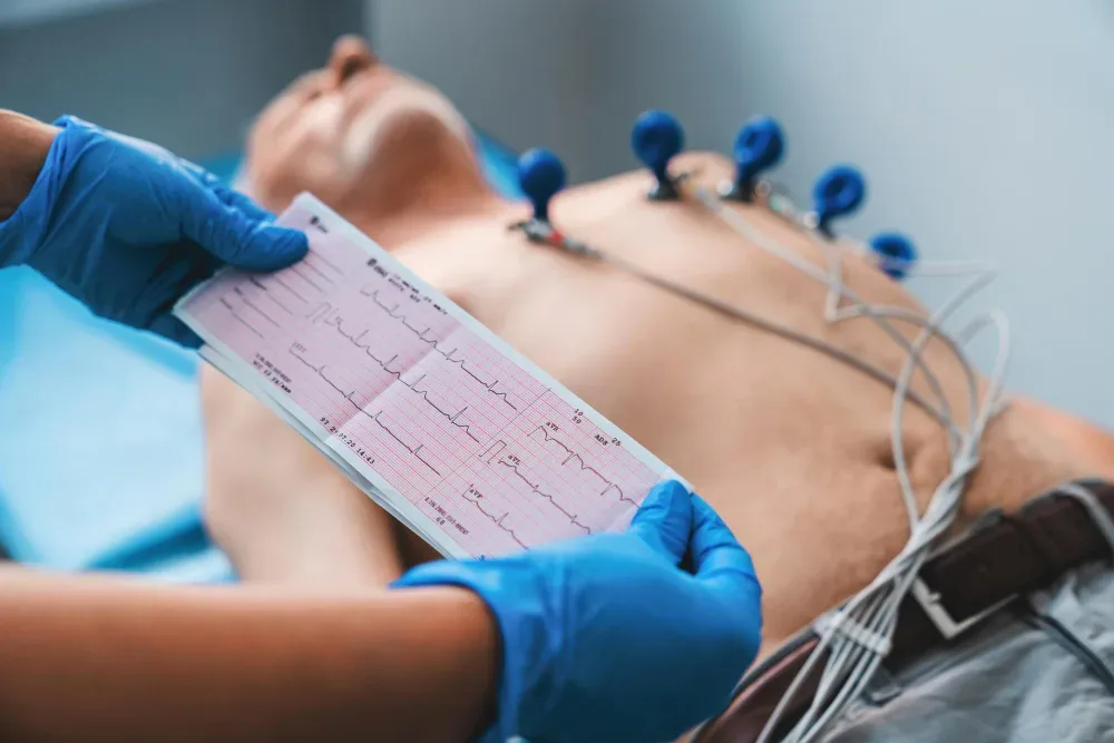 Ecocardiograma